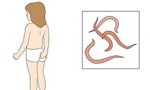 Síntomas de los parásitos en el cuerpo humano