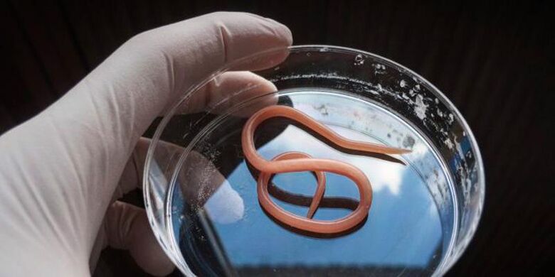 Ascaris es un helminto intestinal redondo que vive en el sistema digestivo.