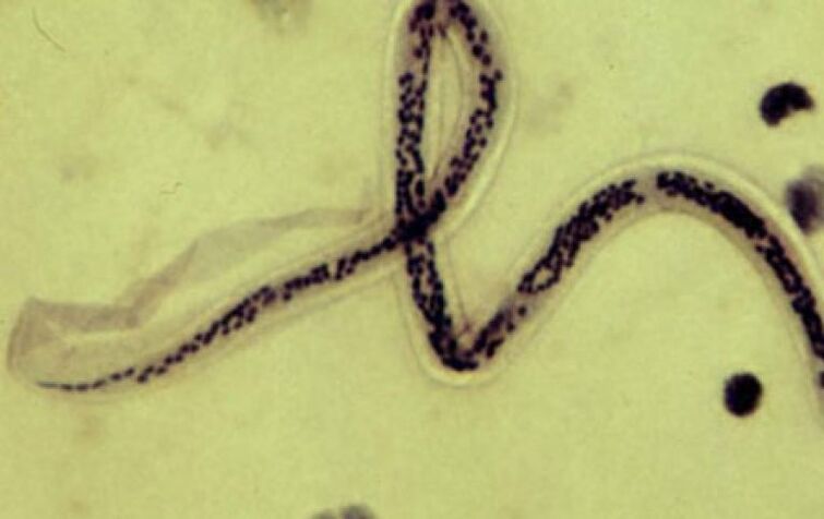filaria del cuerpo humano