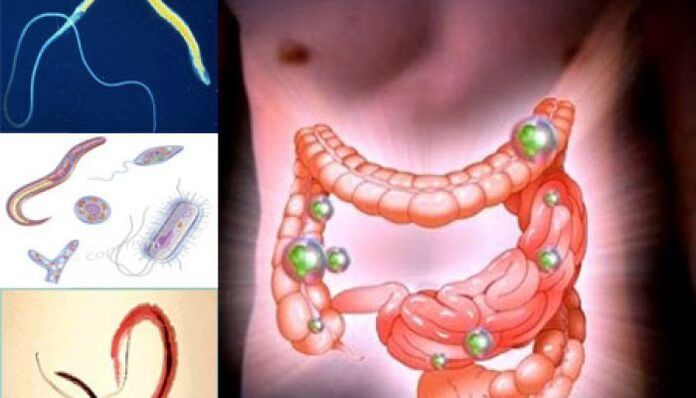 parásitos en el intestino humano